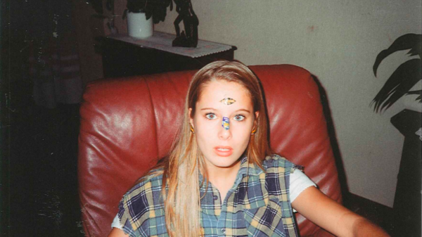 Young woman with fruit stickers on her face.